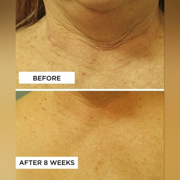 PERRICONE MD Cold Plasma+ Neck and Chest Broad Spectrum SPF 25. NEW 1oz. - Picture 10 of 13